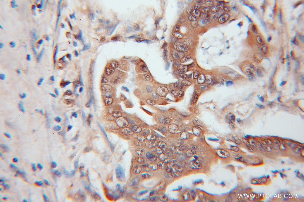 UCHL5 Polyclonal antibody