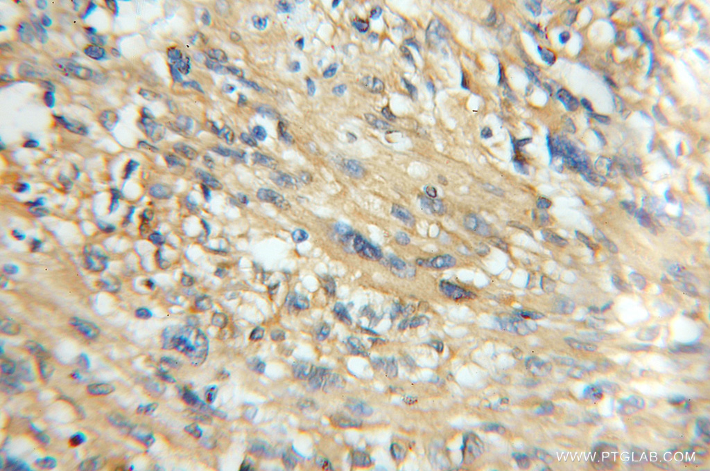 CaMKII Beta Polyclonal antibody