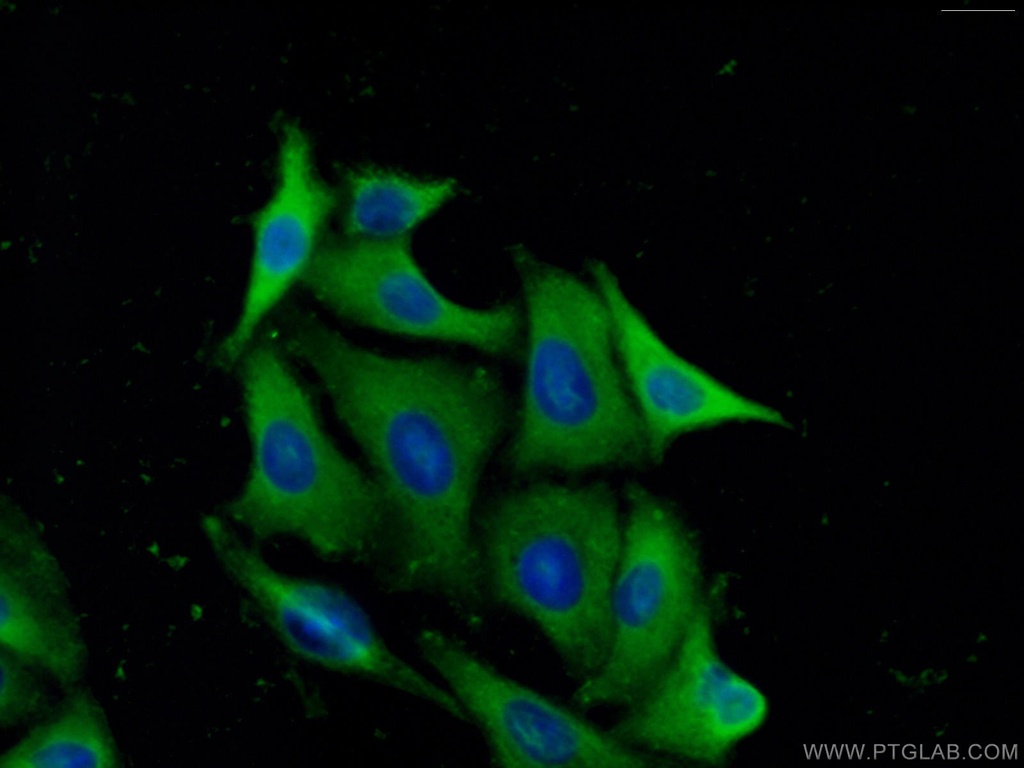 PREP Polyclonal antibody