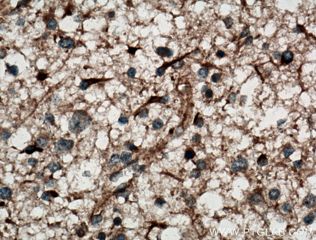 DGKA Polyclonal antibody