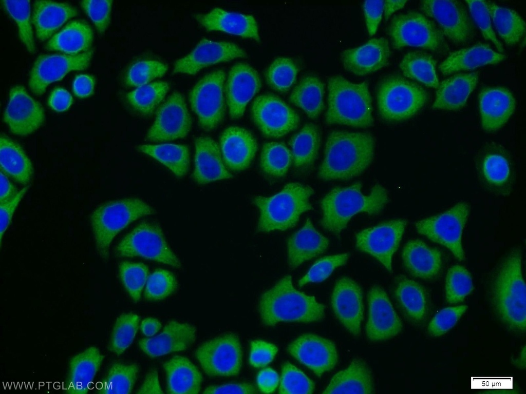 CAMKK2 Polyclonal antibody