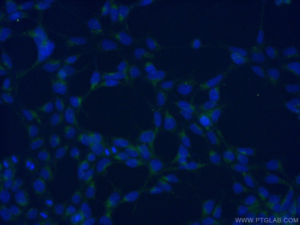 AGTRAP Polyclonal antibody