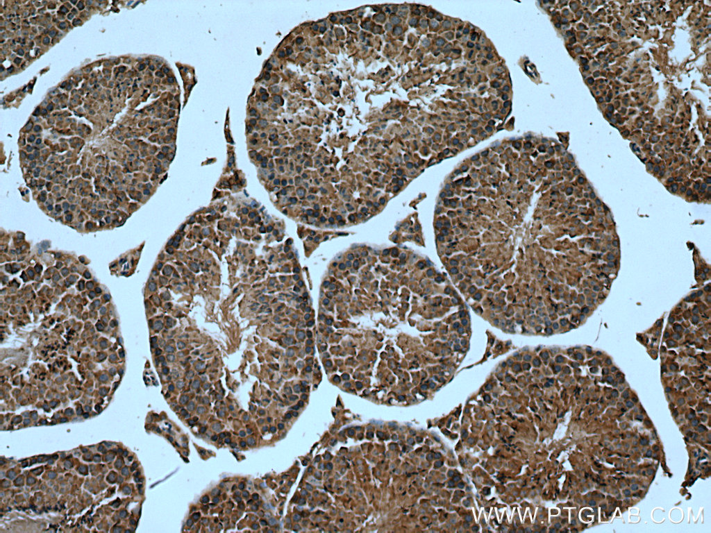 MPP6 Polyclonal antibody