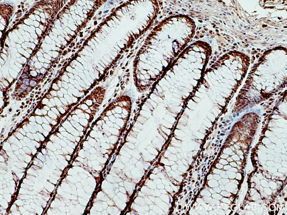 OGT Polyclonal antibody