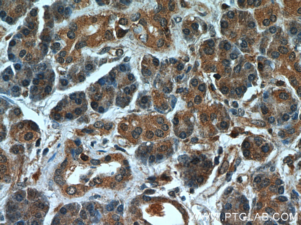 MTRF1 Polyclonal antibody