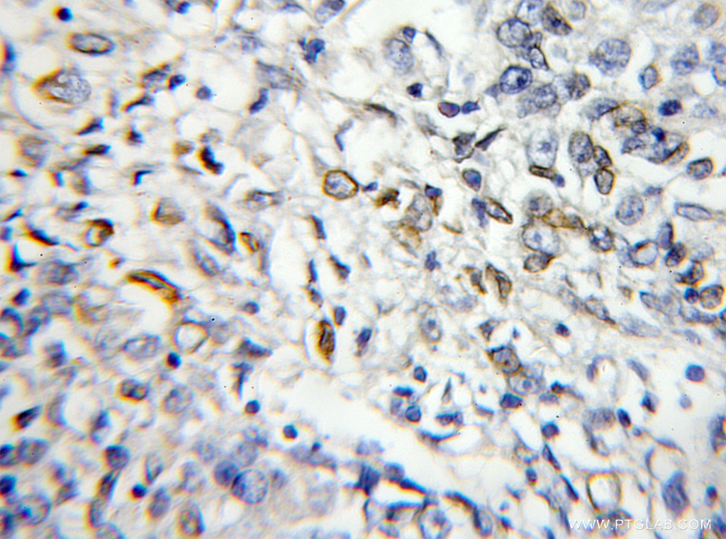 RABL2B Polyclonal antibody