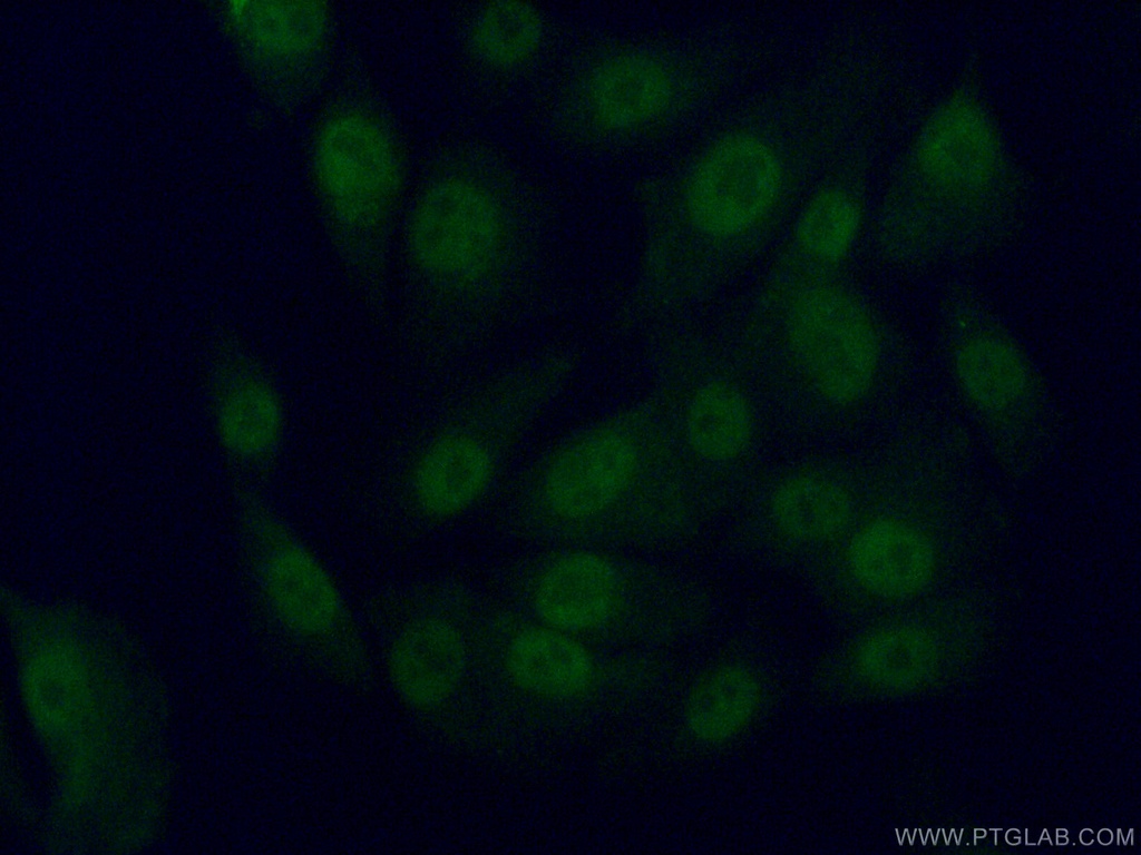 TFIIE Beta Polyclonal antibody