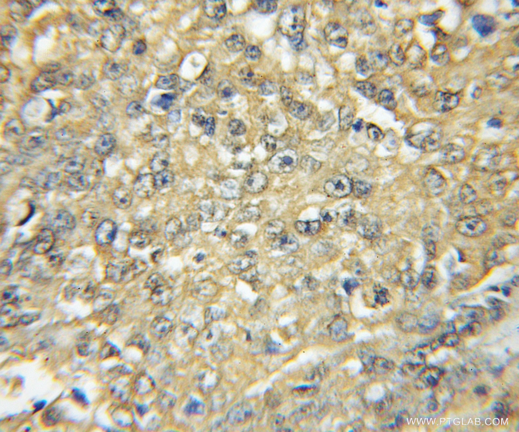HCK Polyclonal antibody