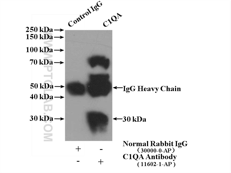 C1qA Polyclonal antibody