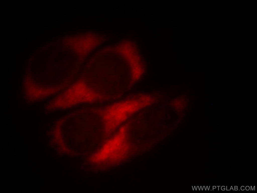 MTX2 Polyclonal antibody