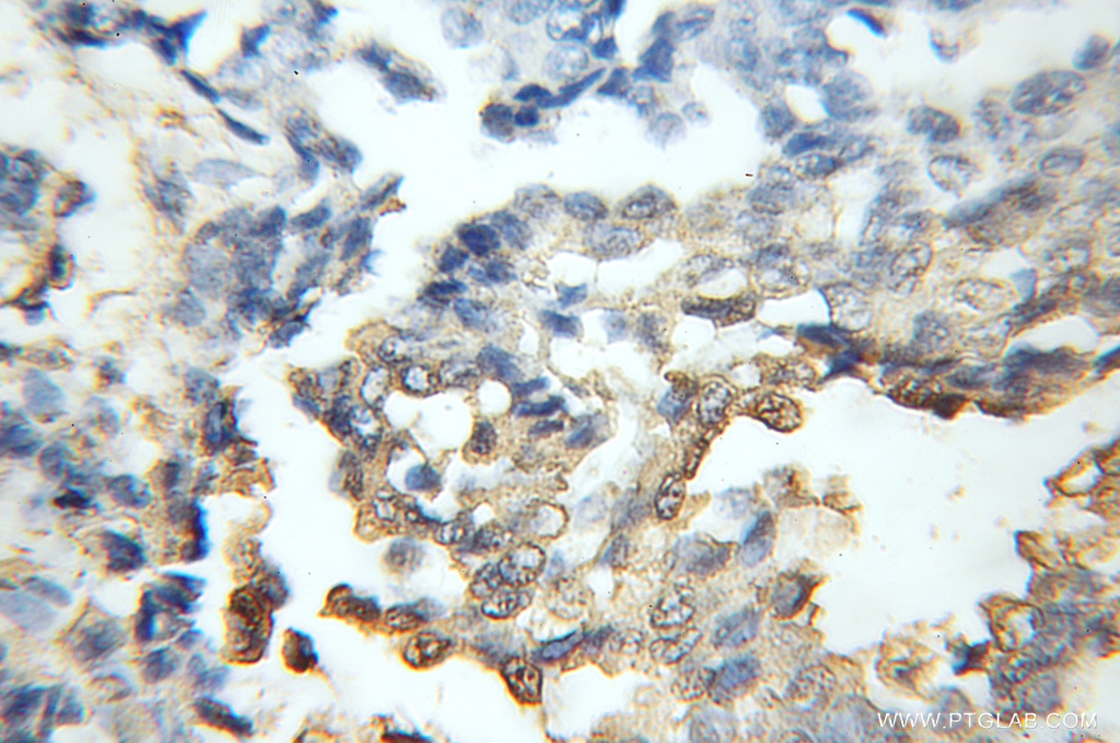 CDR2 Polyclonal antibody