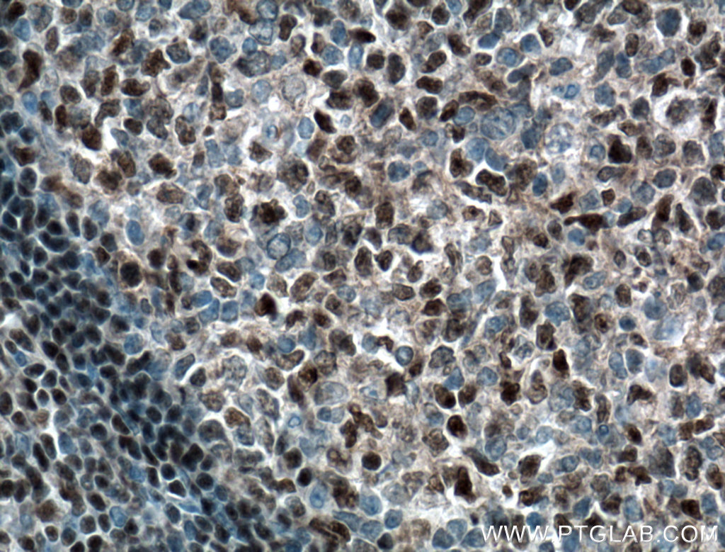 BCL11A Polyclonal antibody