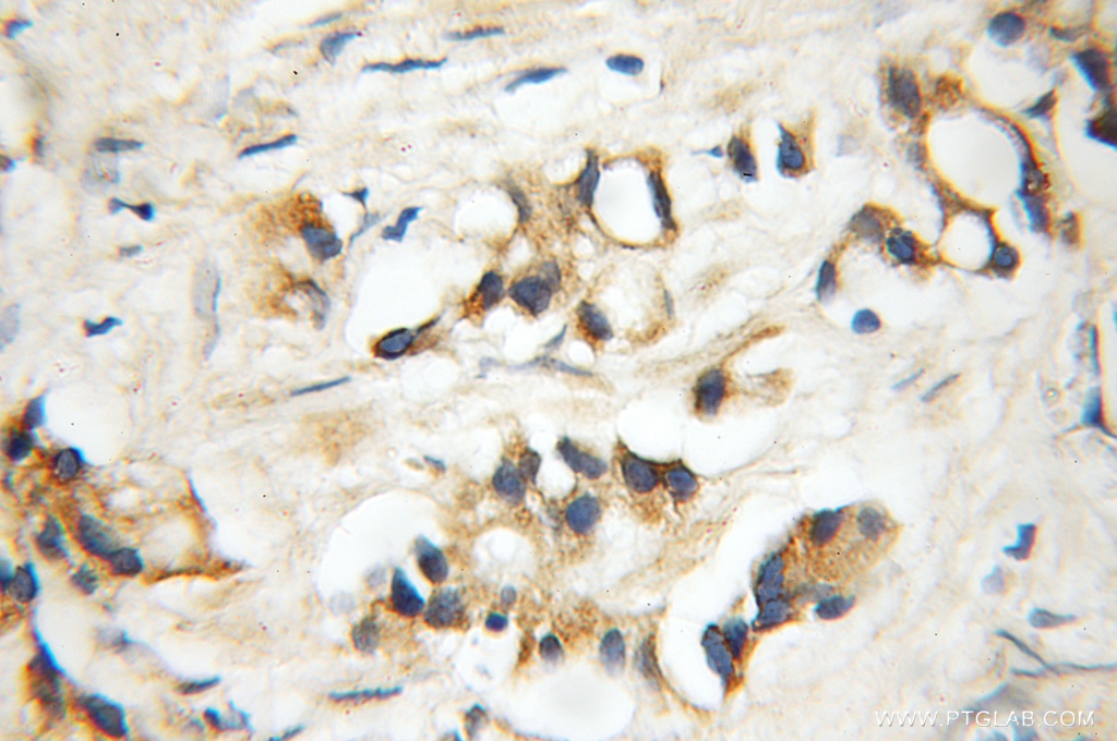 DDX28 Polyclonal antibody