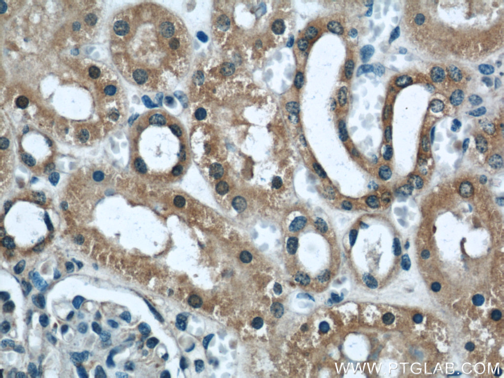 DOCK8 Polyclonal antibody