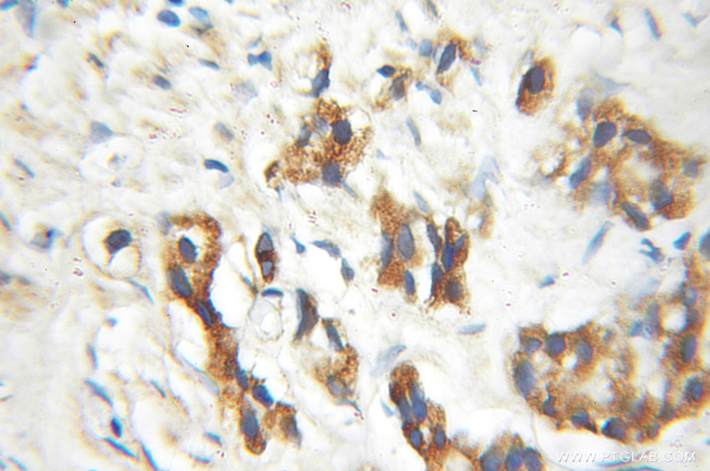 ENTPD6 Polyclonal antibody