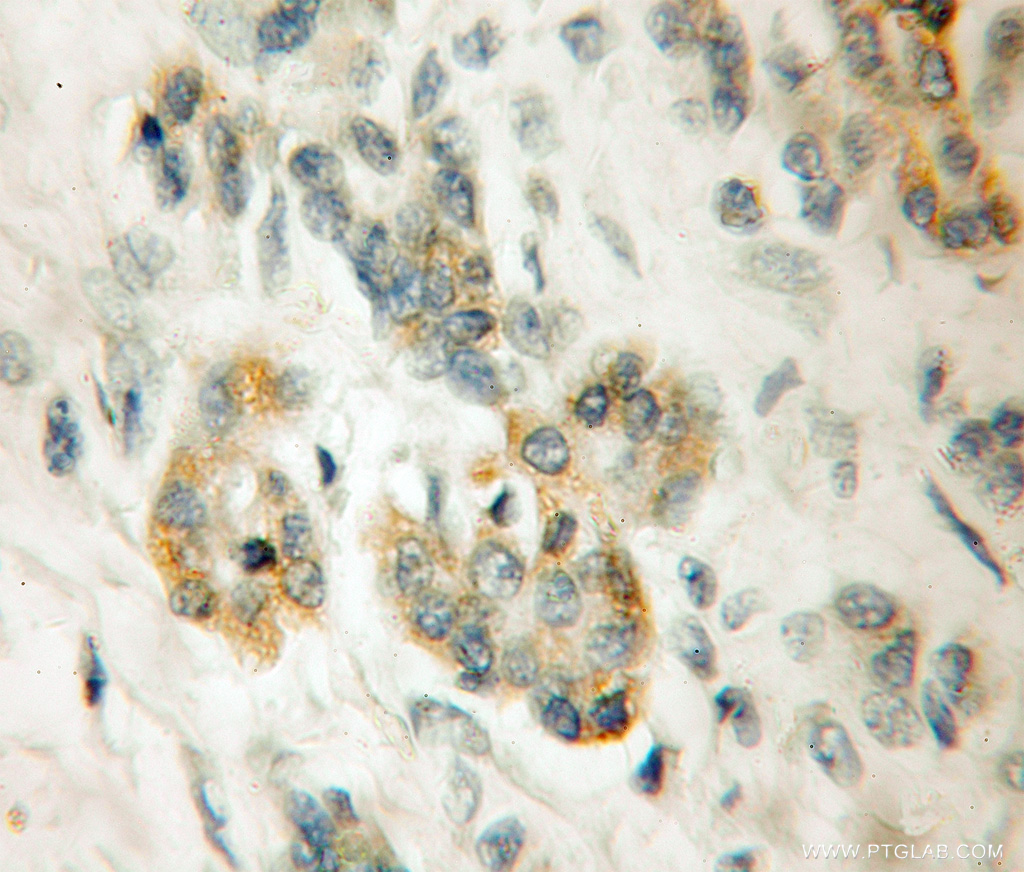 LRR 1 Polyclonal antibody