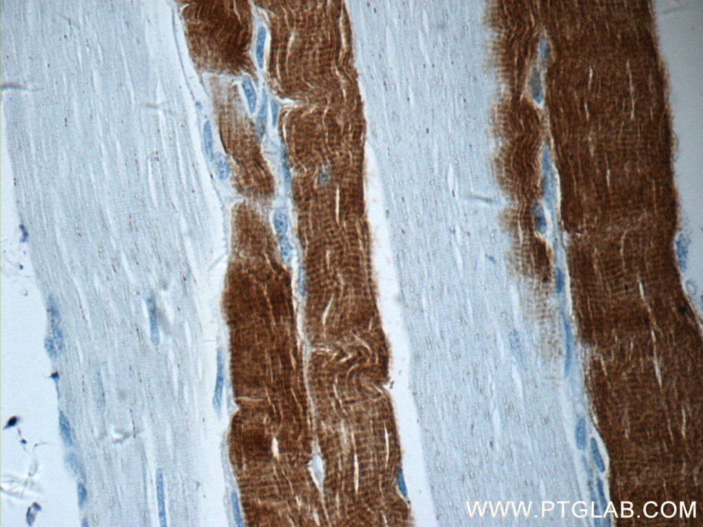 TNNI2 Polyclonal antibody