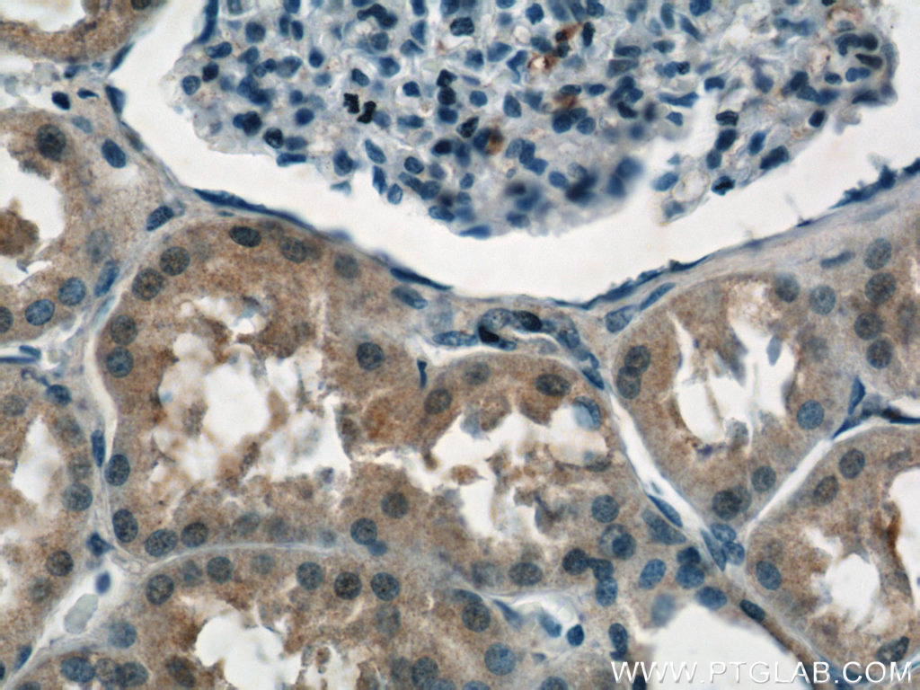 NPLOC4 Polyclonal antibody