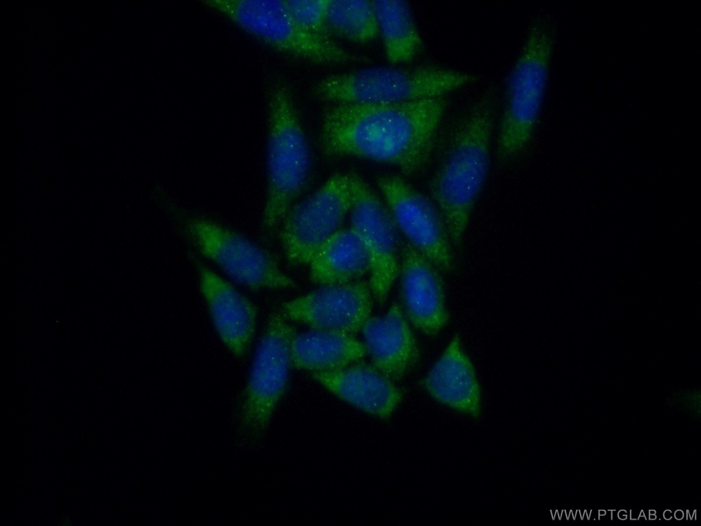 EIF1AX Polyclonal antibody