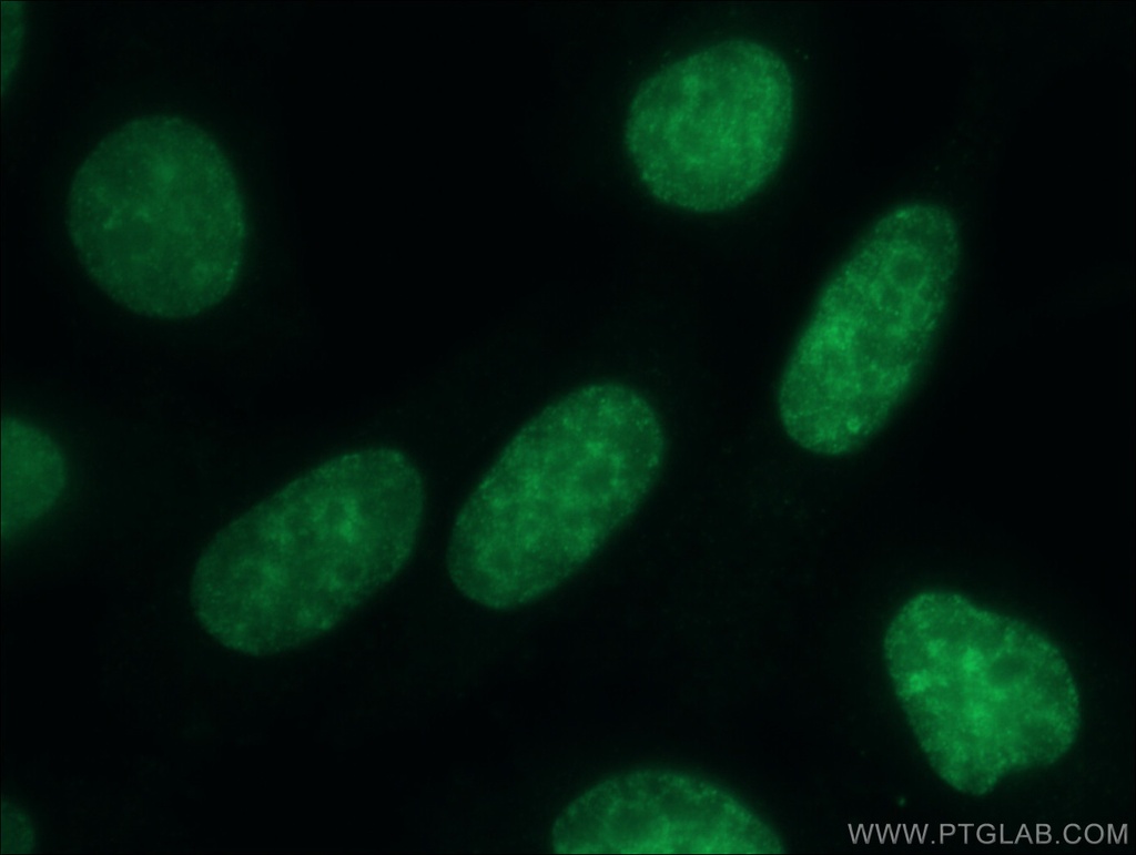 CBX3 Polyclonal antibody