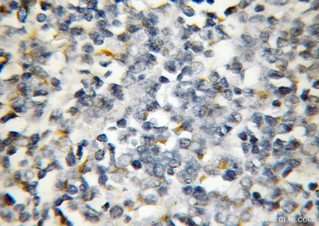 AP4M1 Polyclonal antibody