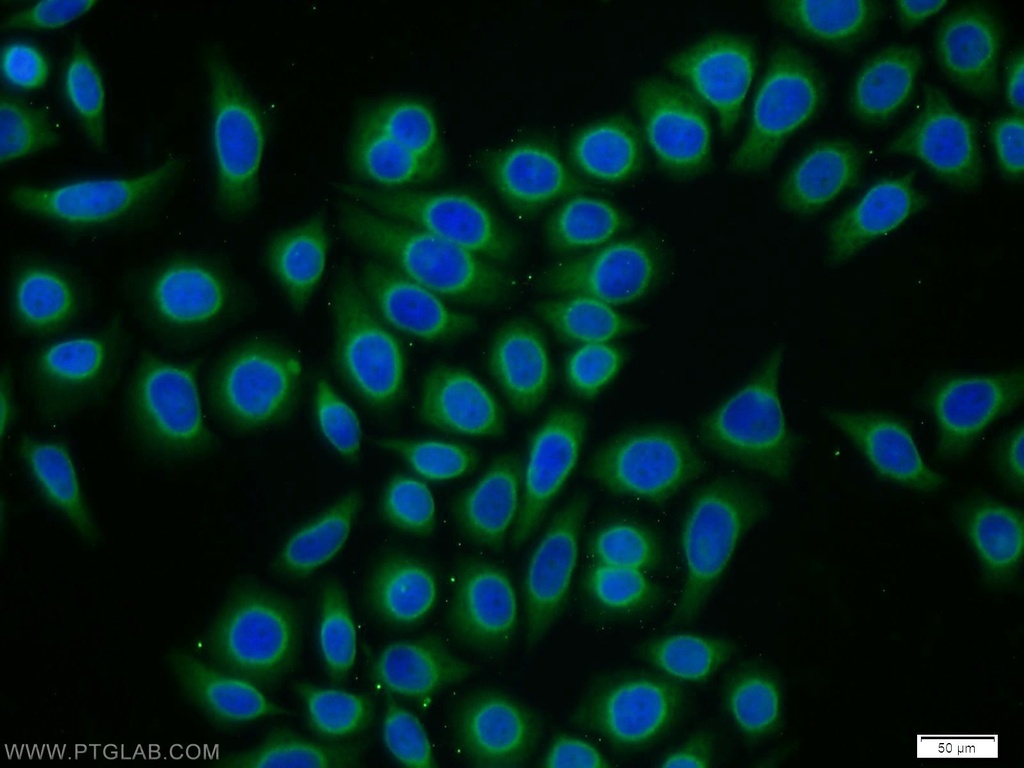 CPI17 Polyclonal antibody