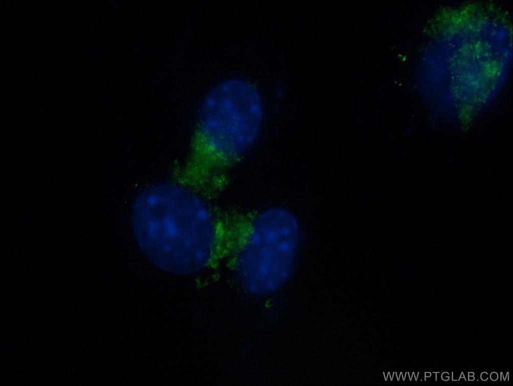 RAB1A Polyclonal antibody
