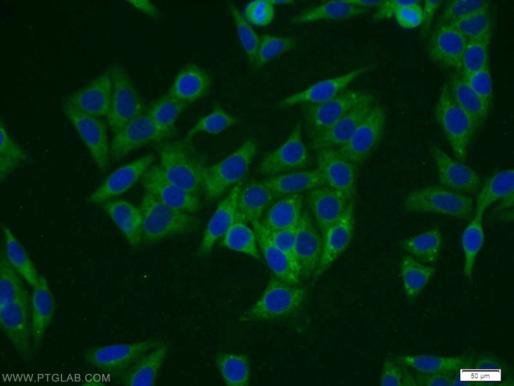 TTC1 Polyclonal antibody