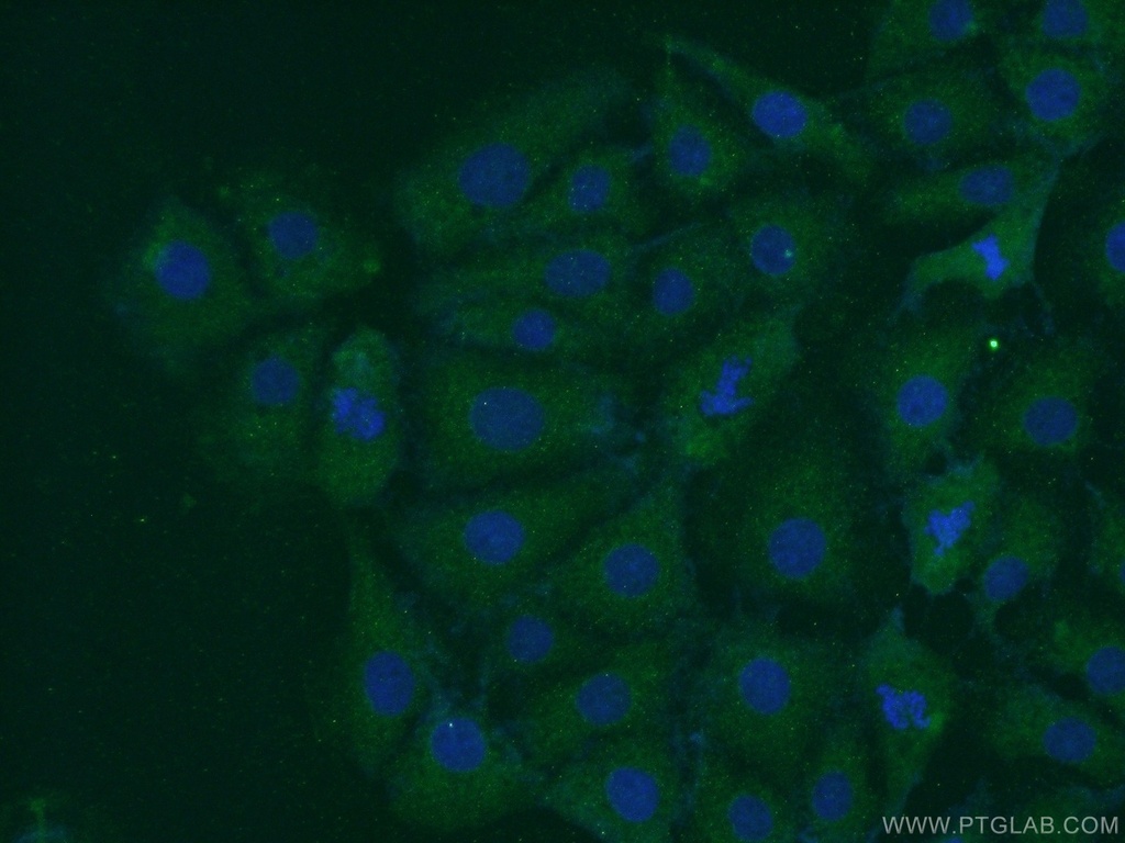 PARK7,DJ-1 Polyclonal antibody