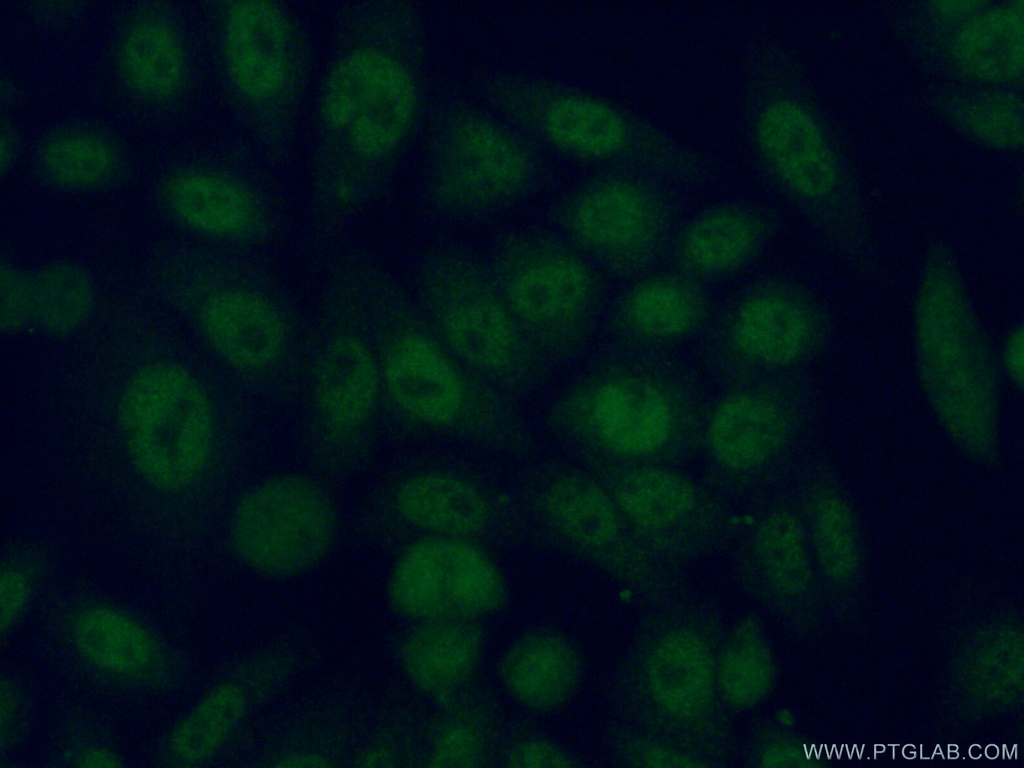 PSMB6 Polyclonal antibody