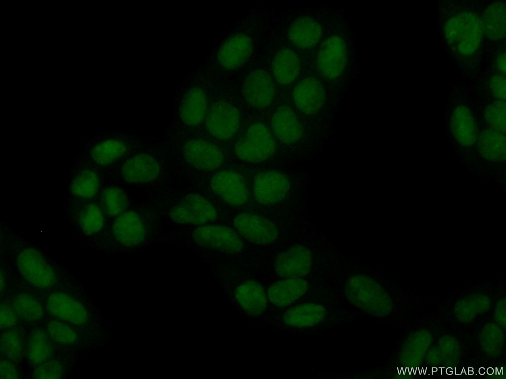 HMGN4 Polyclonal antibody