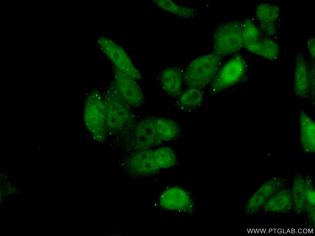 MLH1 Polyclonal antibody