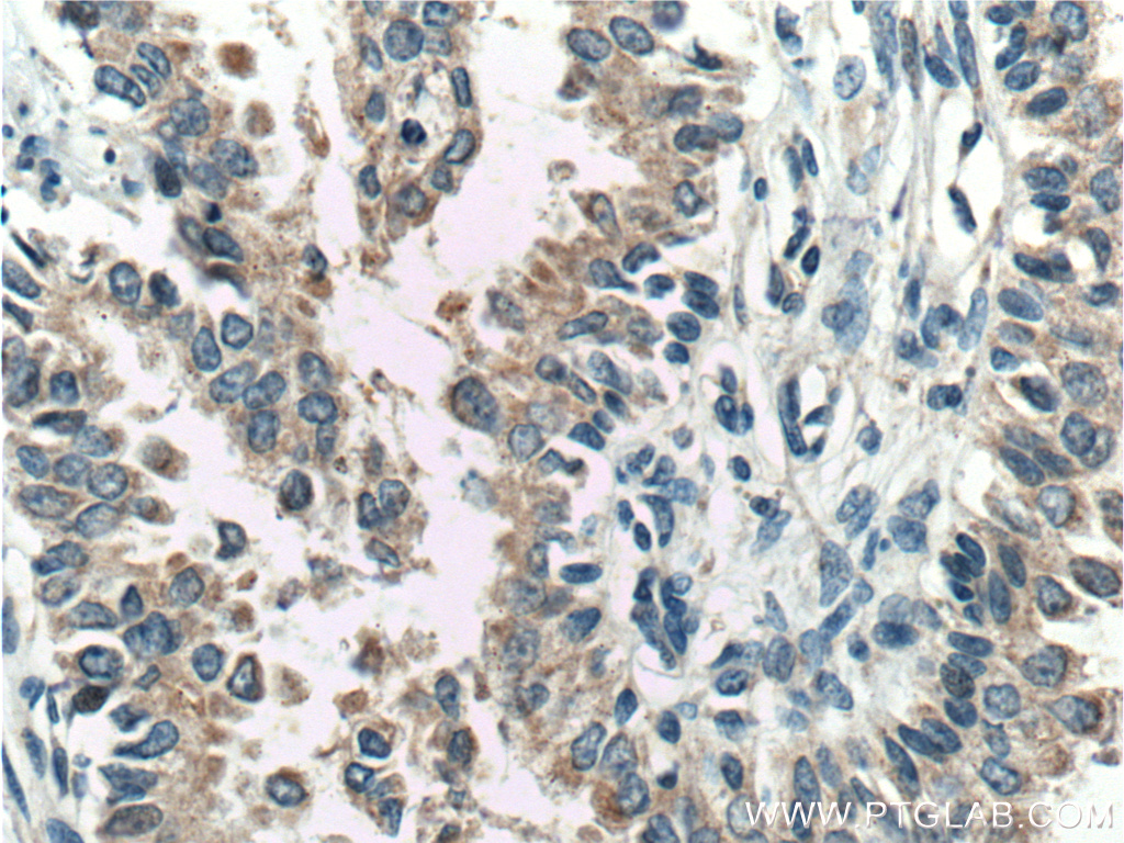 FKBP2 Polyclonal antibody