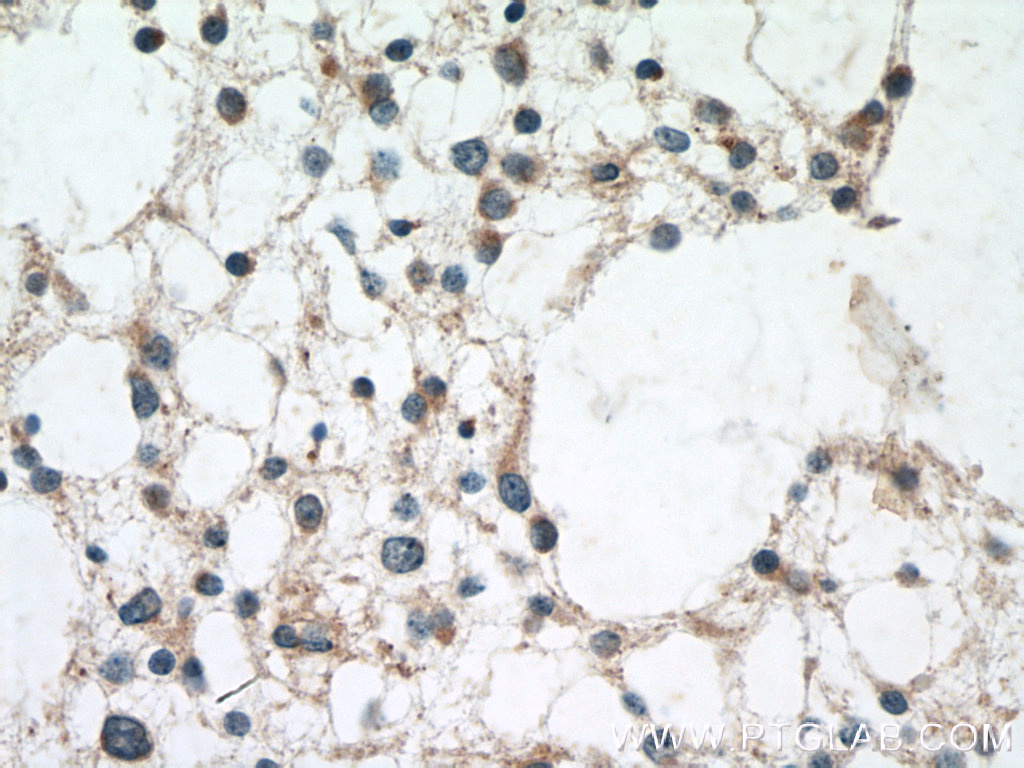 BRE Polyclonal antibody