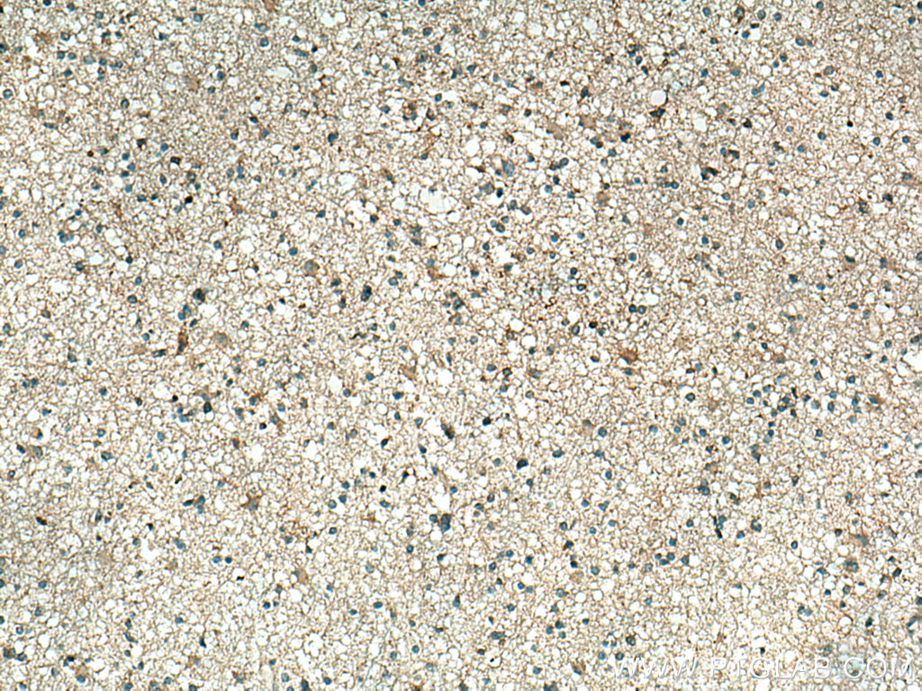 PPP5C Polyclonal antibody