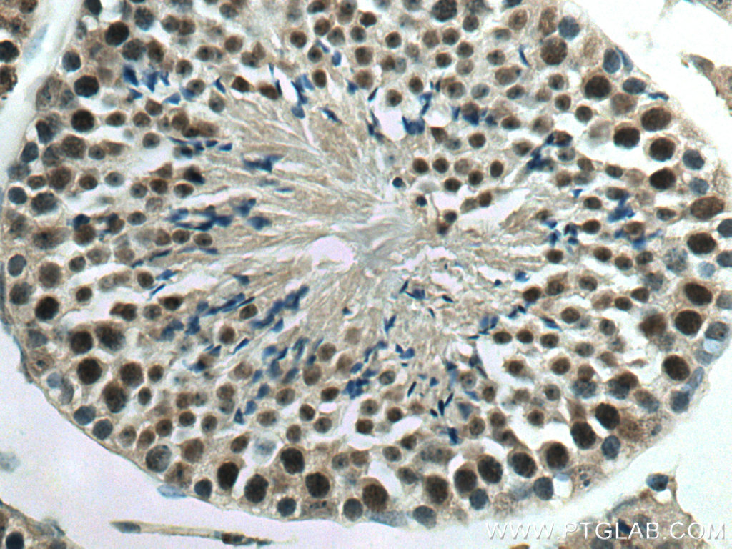 YPEL5 Polyclonal antibody