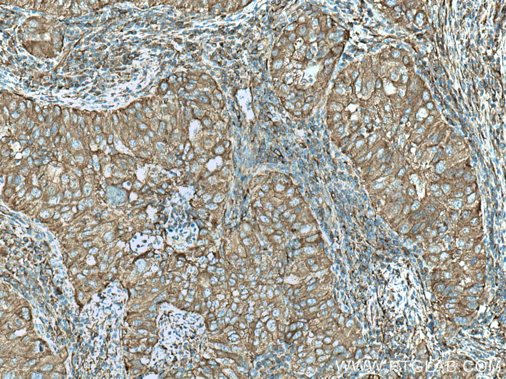 TWF1 Polyclonal antibody