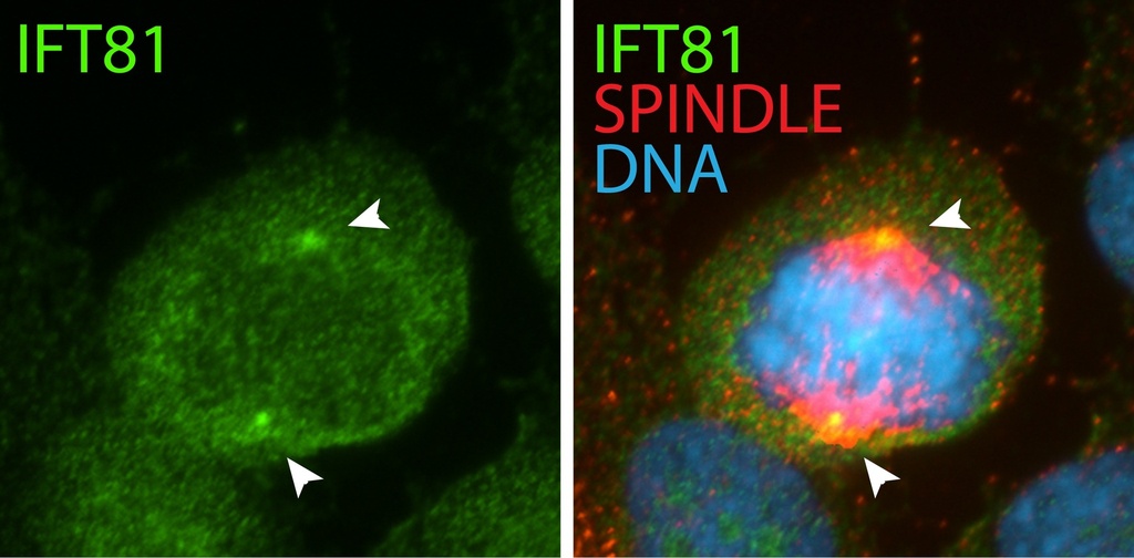 IFT81 Polyclonal antibody