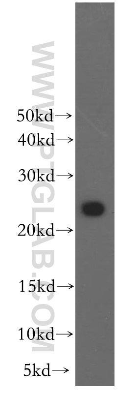 RAB2B Polyclonal antibody