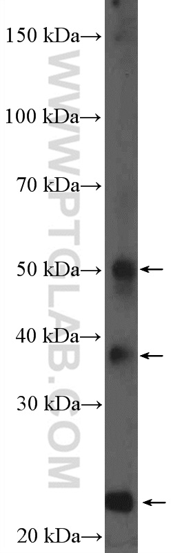 HFE2 Polyclonal antibody