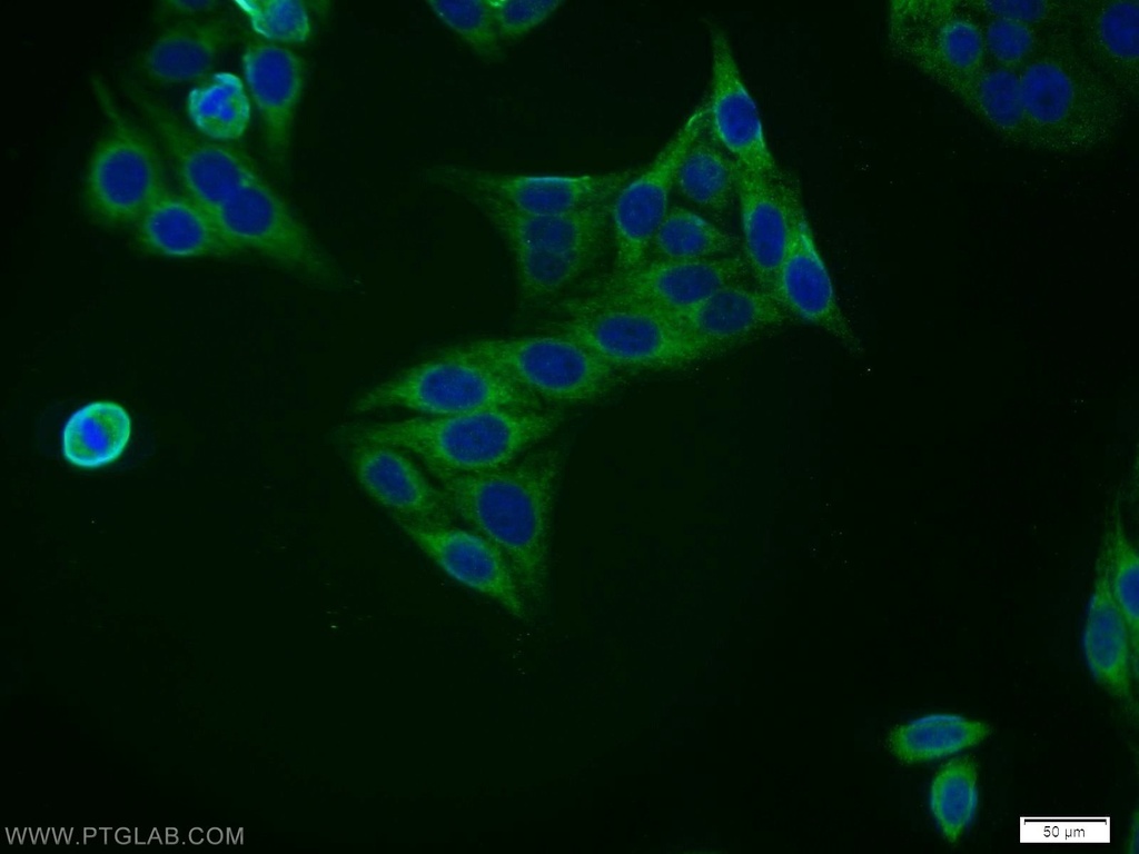 ZNF395 Polyclonal antibody