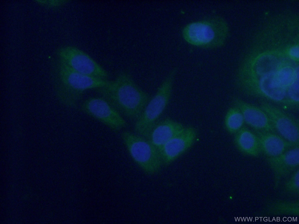 NUDCD3 Polyclonal antibody