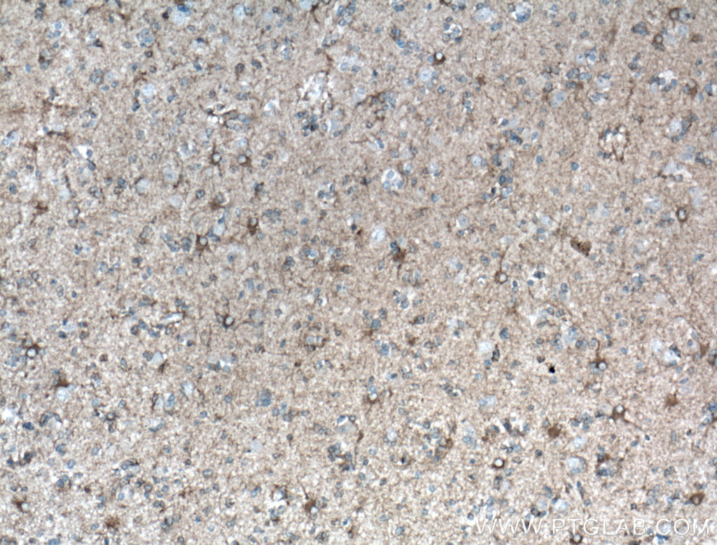 SEPT8 Polyclonal antibody