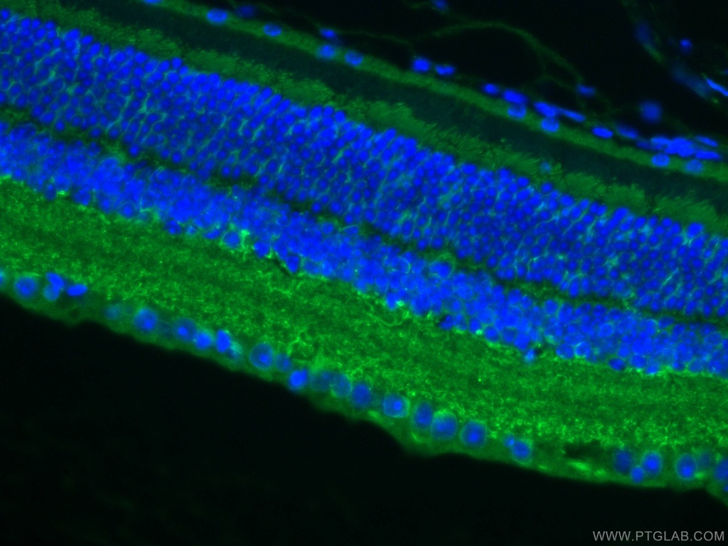 RBP4 Polyclonal antibody