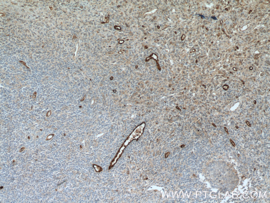 VWF, VWFpp Polyclonal antibody