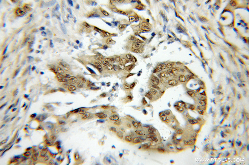 TRAF7 Polyclonal antibody