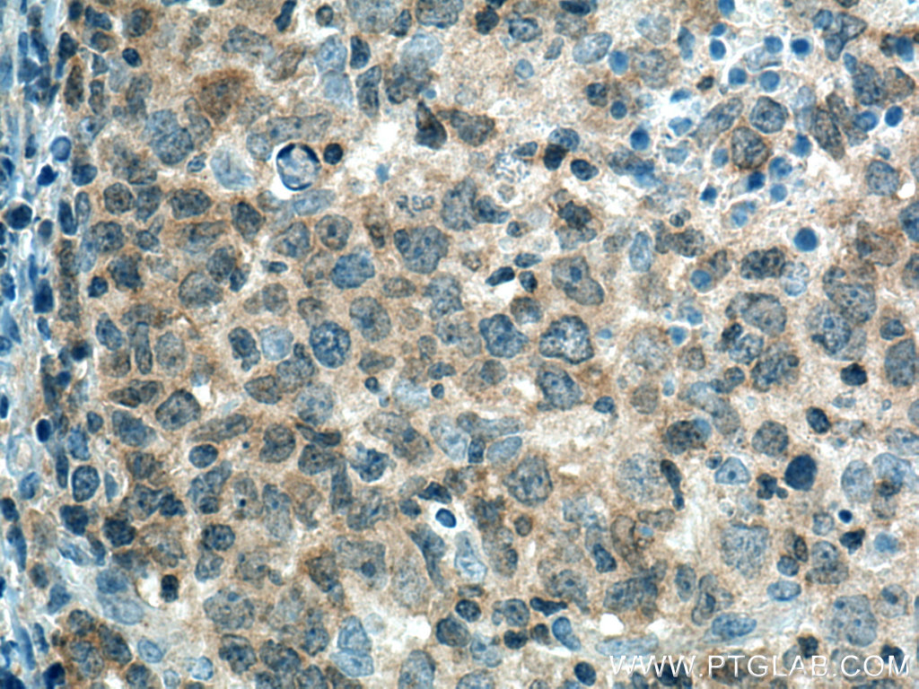PTPN22 Polyclonal antibody