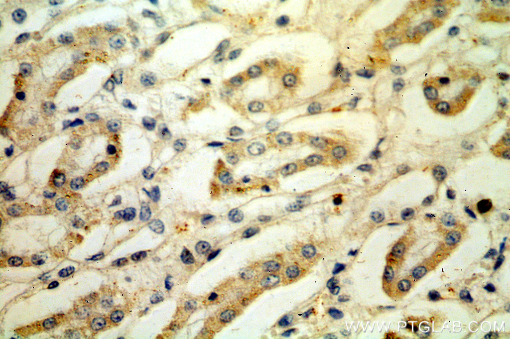LY96/MD2 Polyclonal antibody