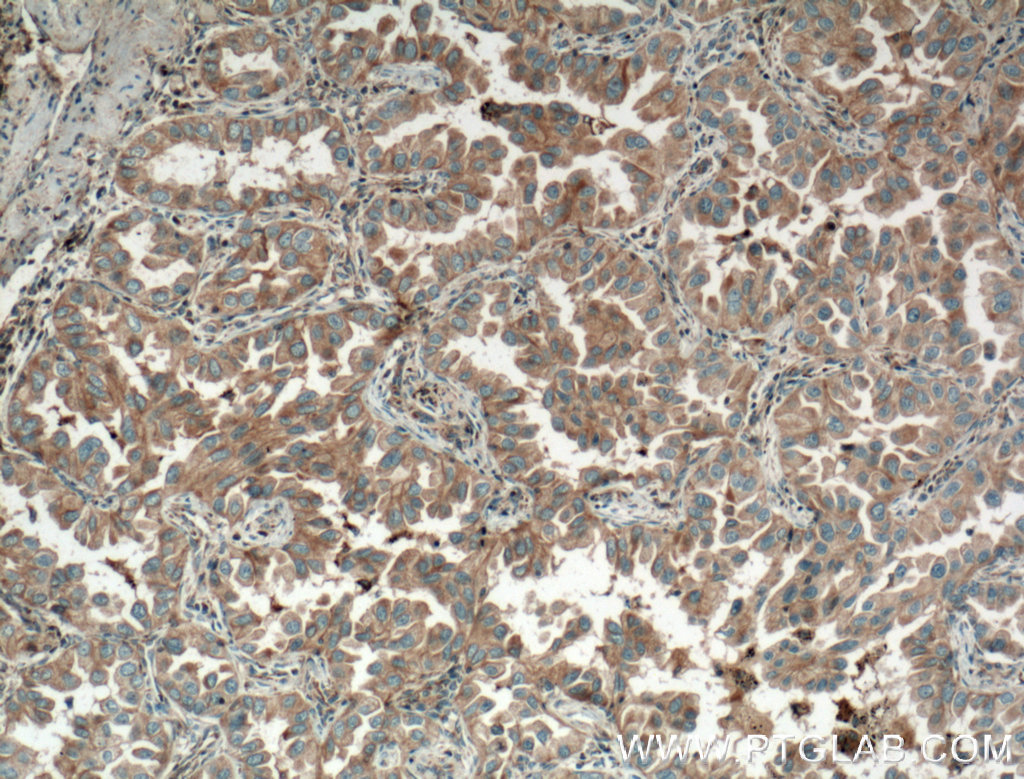 Eotaxin Polyclonal antibody