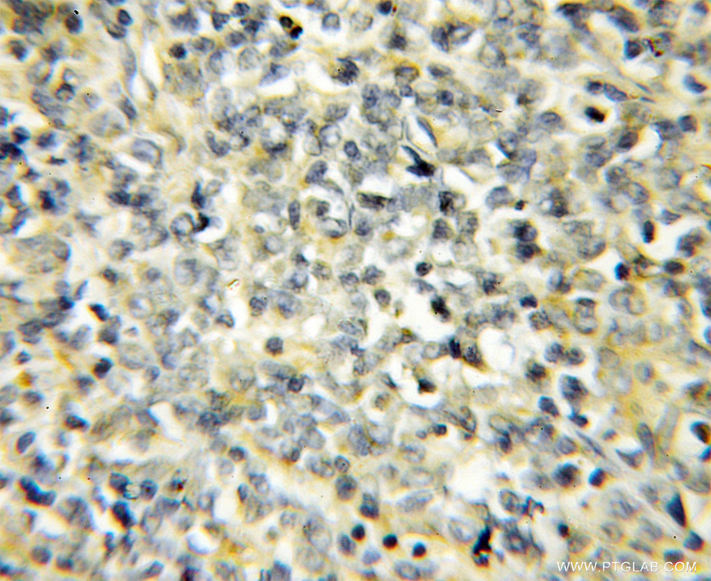 NIPSNAP3B Polyclonal antibody
